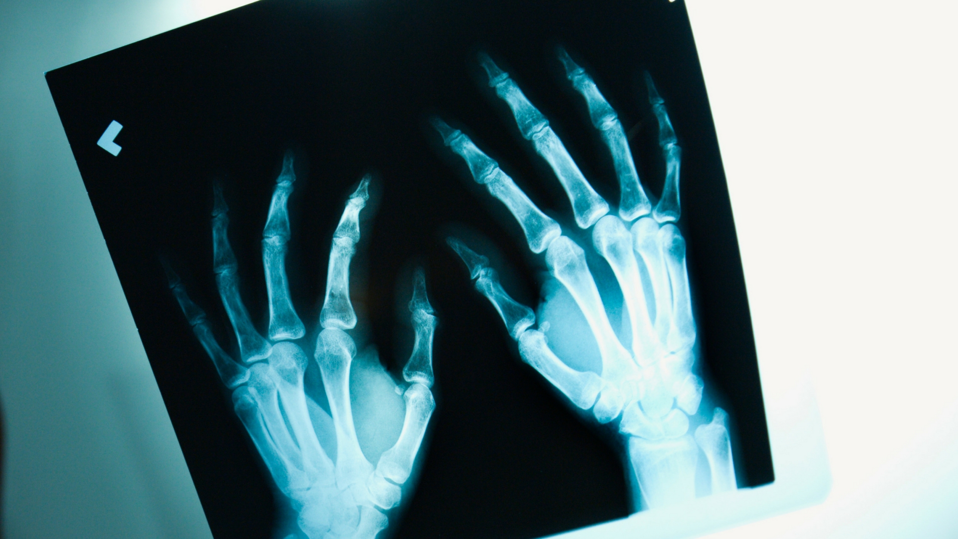 Modulating the properties of biomaterials to better suit bone tissue engineering and drug delivery applications